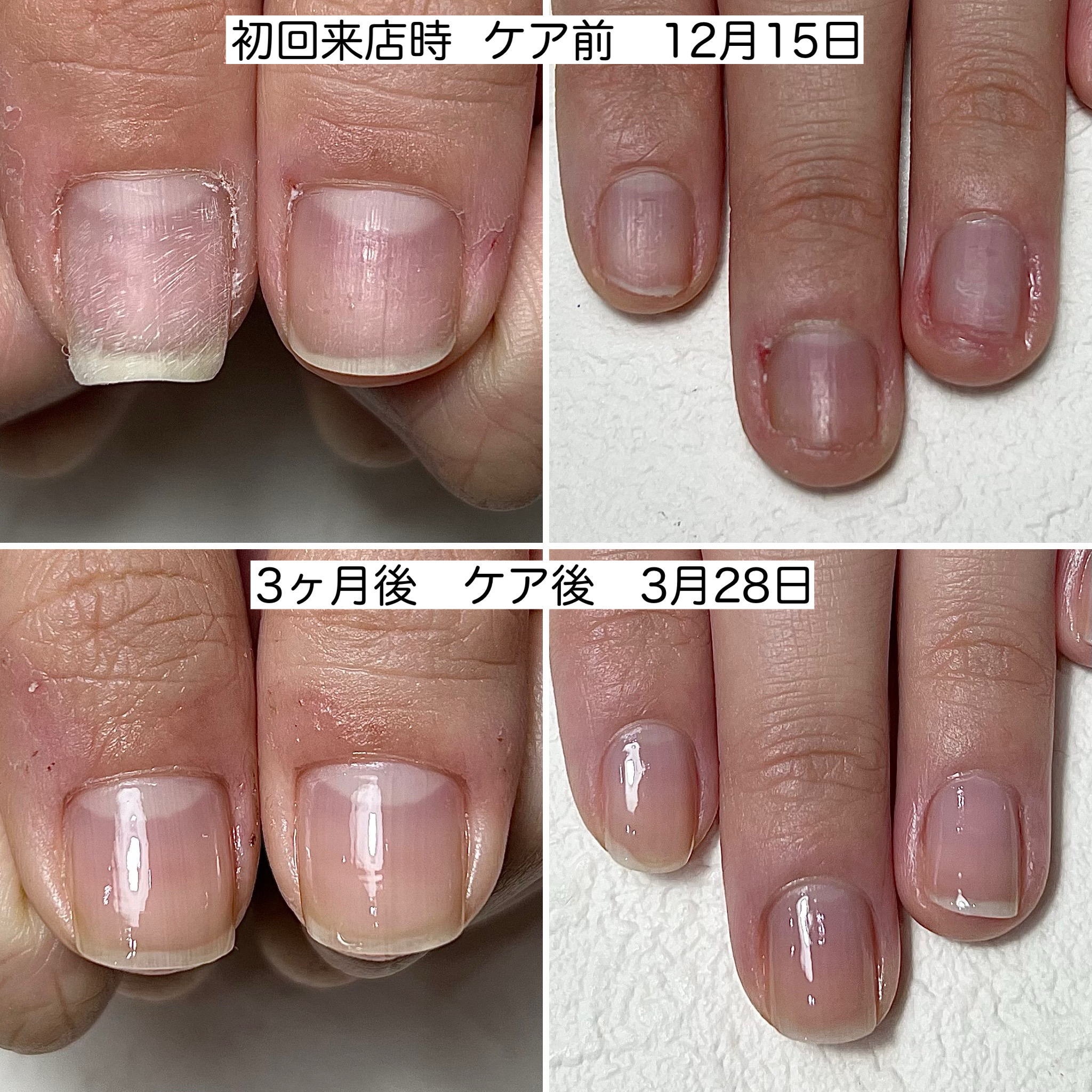 地爪育成:ケア前/ケア後