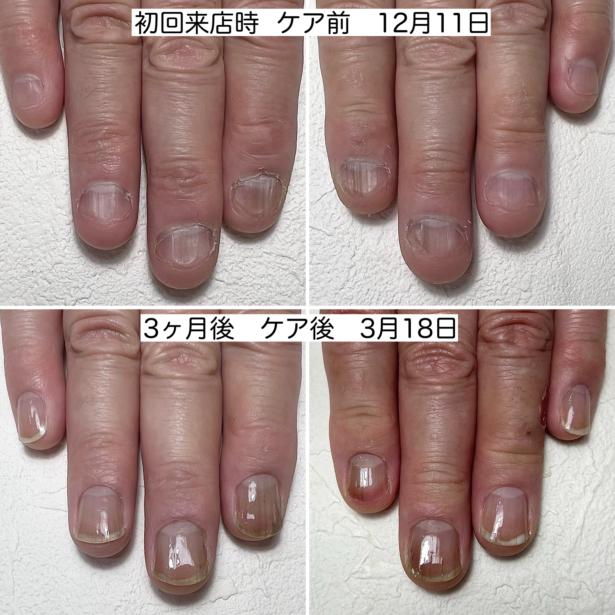 地爪育成:ケア前/ケア後